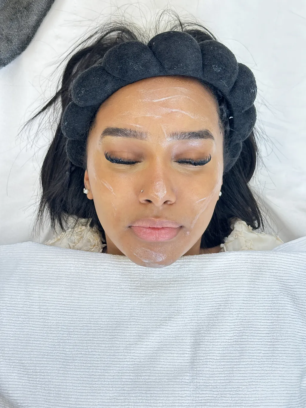 La Skin transformation