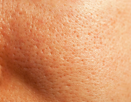 beaute_inee_index_benefit3_alt